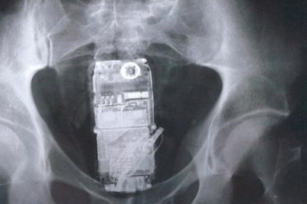 Se escondió un celular en sus partes íntimas e intentó ingresarlo a la cárcel de Piñero