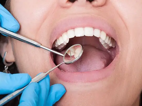 Se realizará “Sacale la lengua al cáncer”: una jornada de prevención de cáncer bucal en el CAPS Pueblo Nuevo
