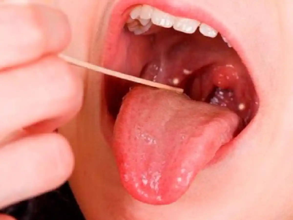 En la ciudad de Buenos Aires se reforzaron las guardias pediátricas y se utilizan reactivos rápidos.