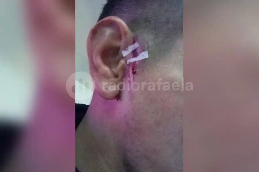 Violenta agresión: un jugador hirió con un cuchillo a otro en la Liga Santafesina