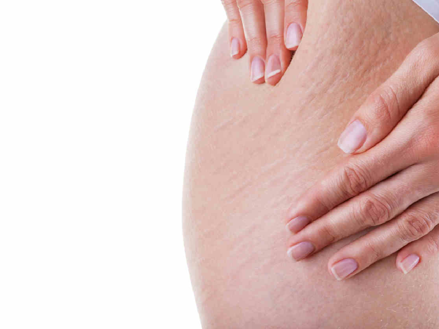 Nuevo tratamiento podría terminar con la celulitis