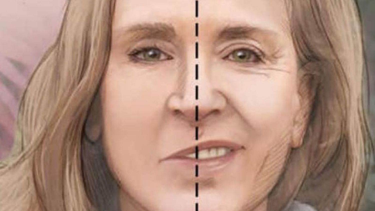Causas y consecuencias de la parálisis facial