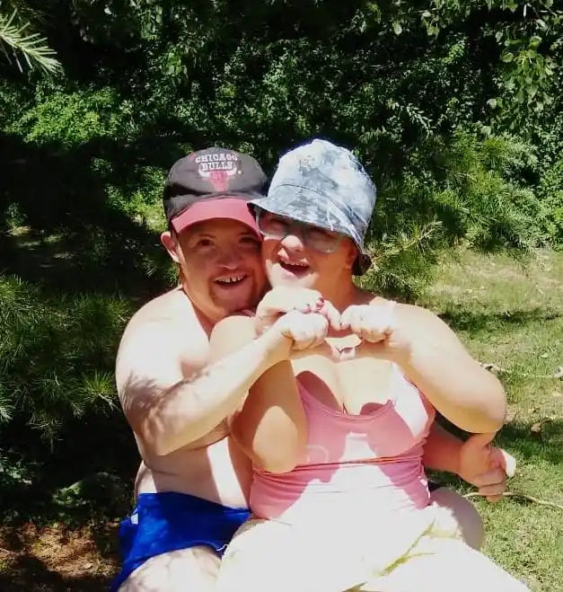 Sindrome de down - 3