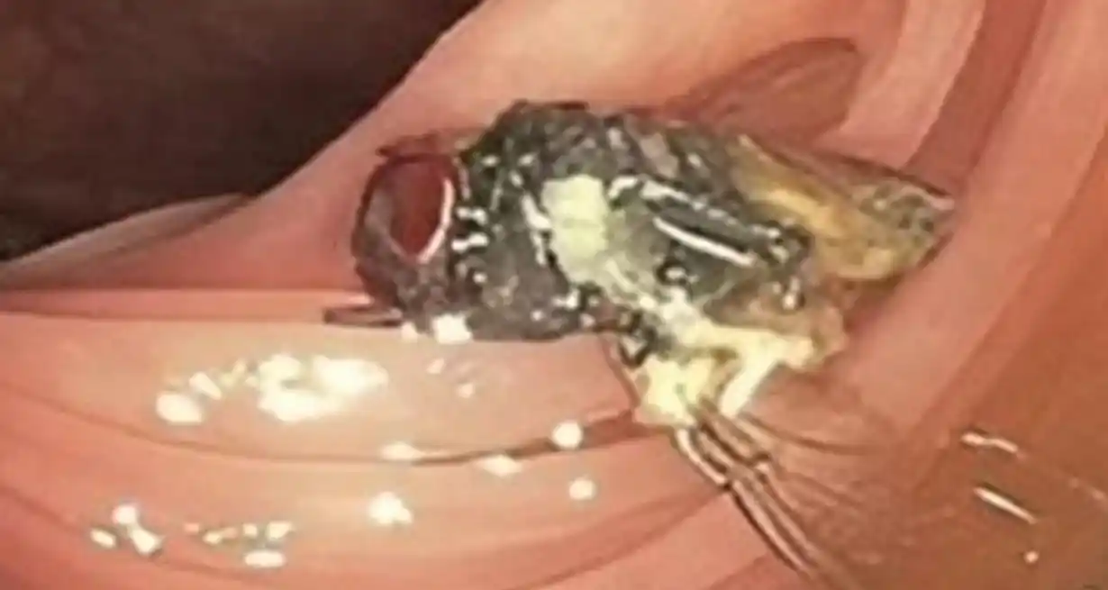 Imagen: American Journal of Gastroenterology.