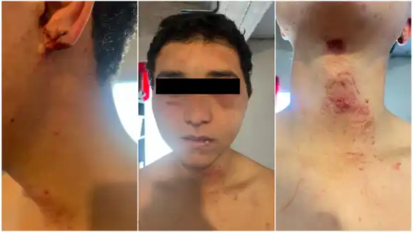 Terror en Vedia: un peón denunció que sus jefes lo torturaron y amenazaron con “hacerlo desaparecer” en cal viva