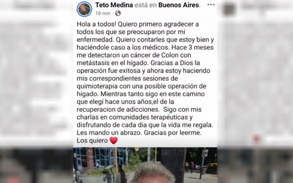 Teto Medina