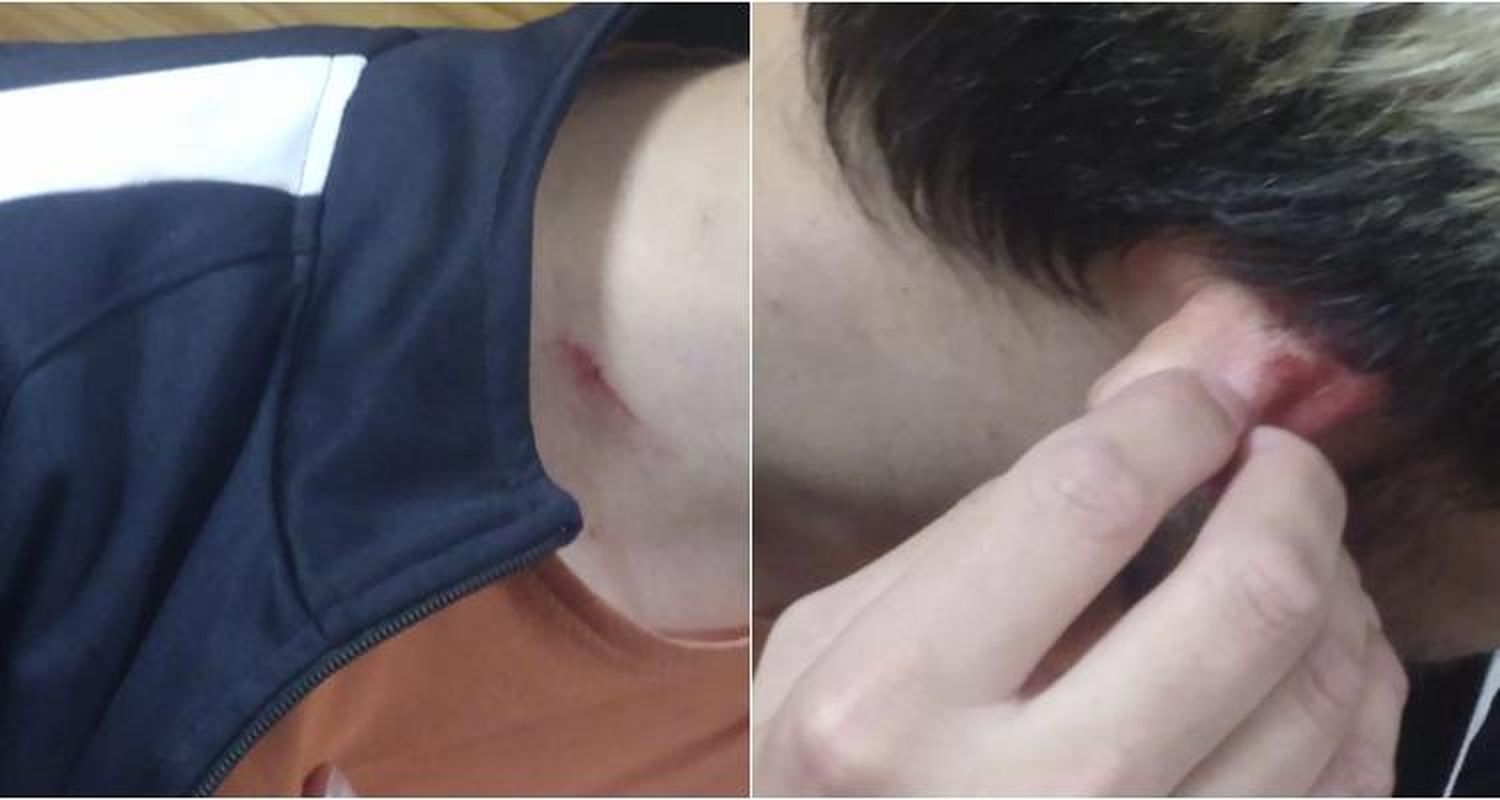 Homofobia en Santa Lucía: Dos hombres golpearon brutalmente a una pareja