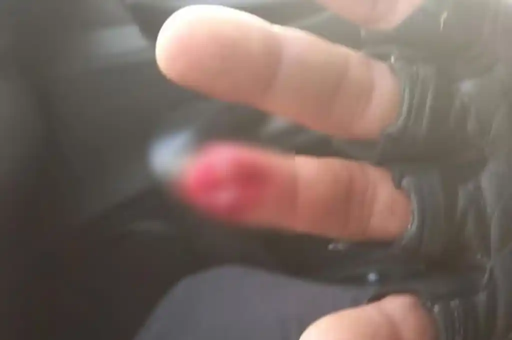 Un automovilista se resistió a un control, le mordió el dedo a un policía y se lo comió