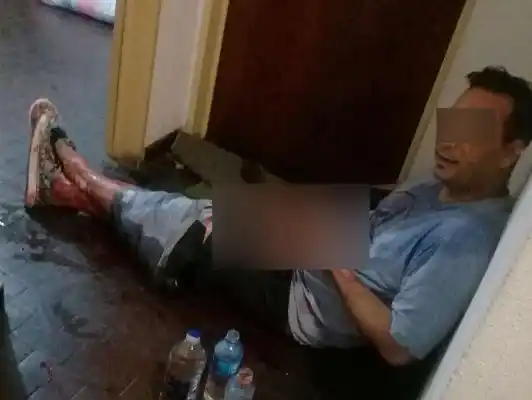 El estado de salud del cordobés al que le cortaron el pene con una tijera de podar  