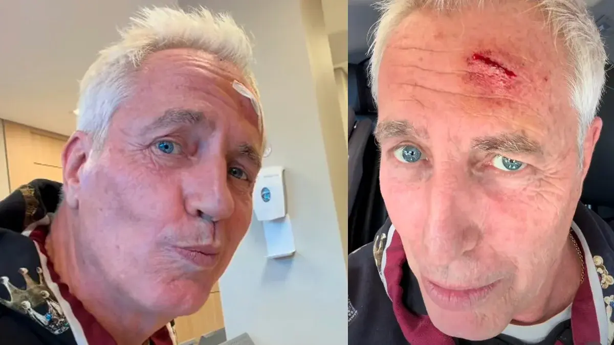 Marley sufrió un fuerte golpe en la cabeza y debió recibir atención médica