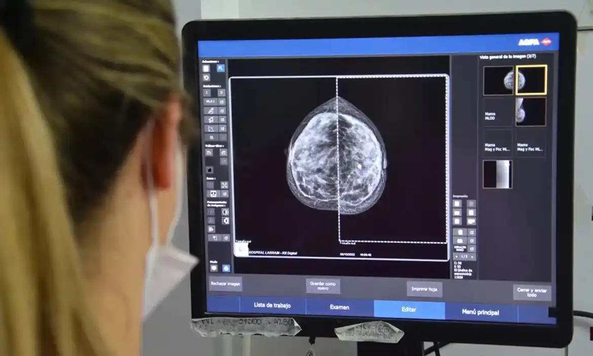 Prevención del cáncer de mama: el gobierno bonaerense comenzará a indicar la mamografía a los 40 años