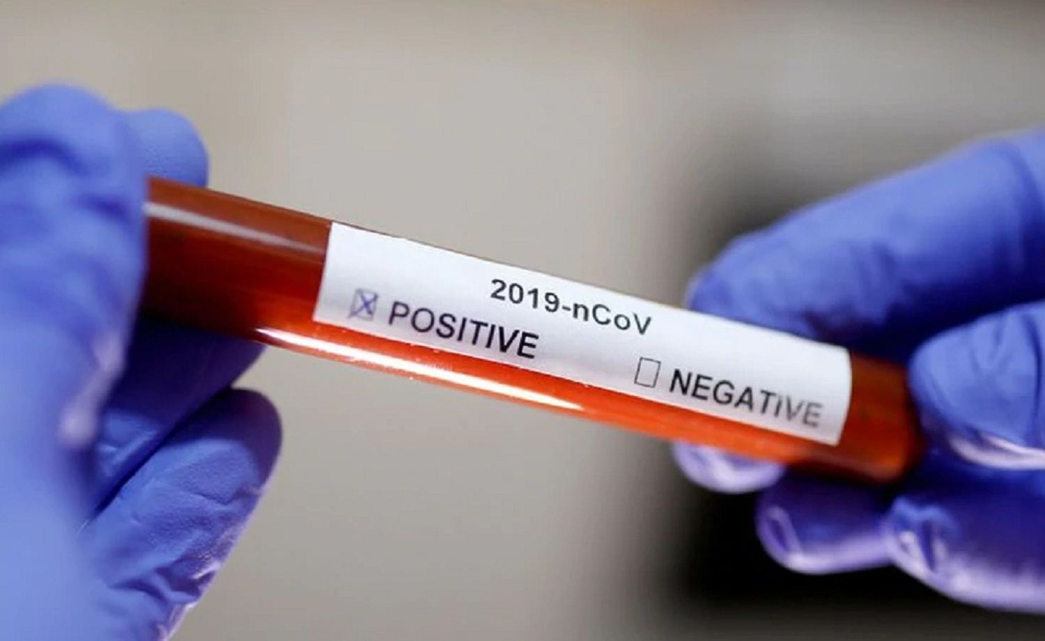 Coronavirus en Entre Ríos: 2 casos confirmados, 10 en estudio y 12 descartados