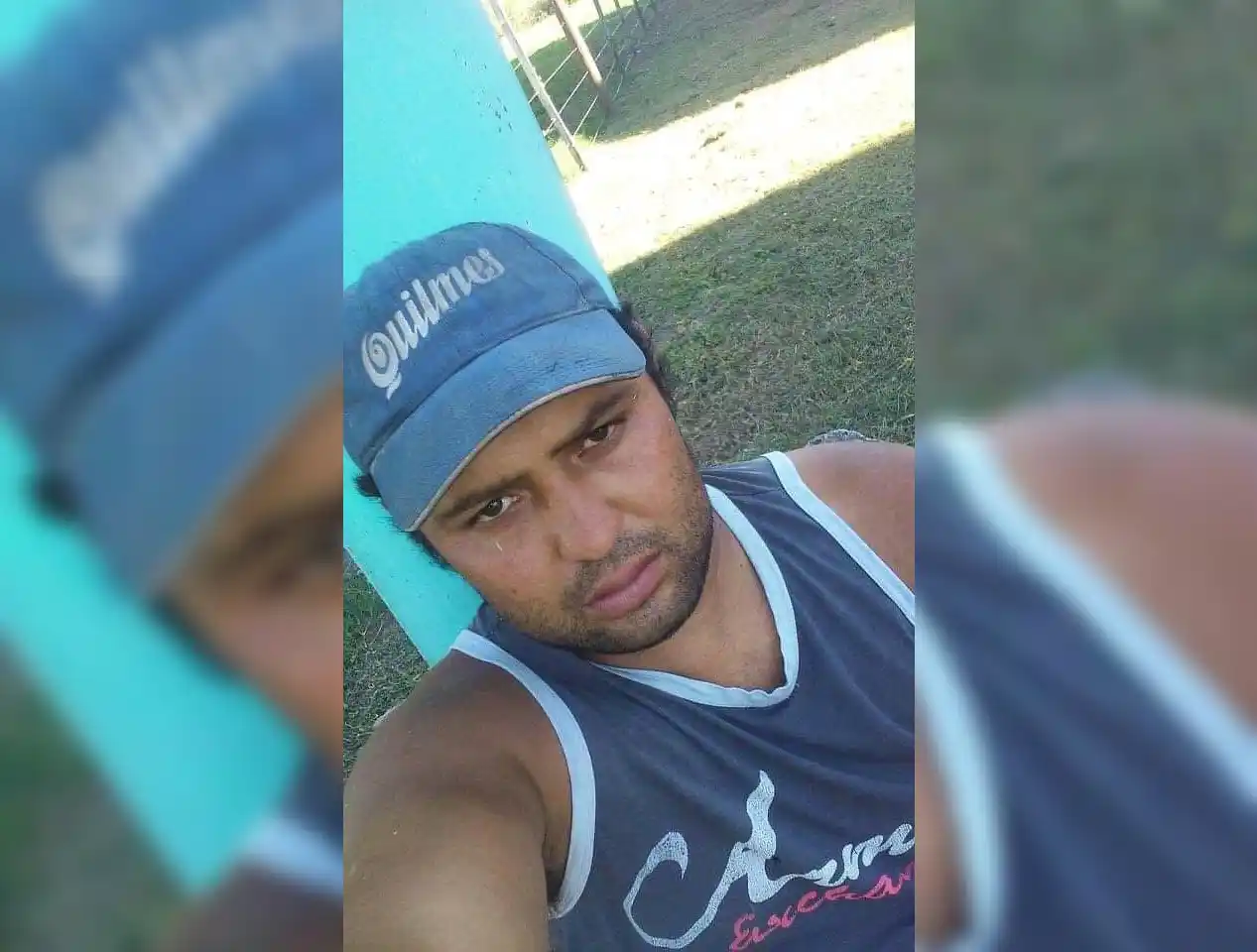 No tiene obra social y hace cuatro años espera una prótesis: “A la noche no puedo dormir porque el dolor es inaguantable”