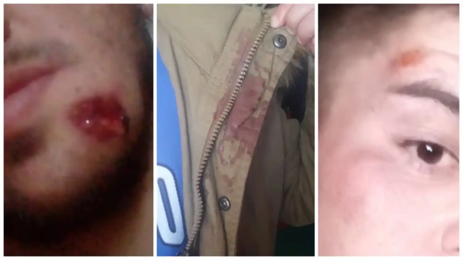 Cárcel de Saavedra: denuncian al personal penitenciario por disparos y golpes