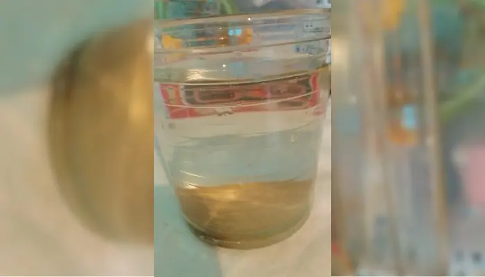 ¿A alguien más le sale el agua así?