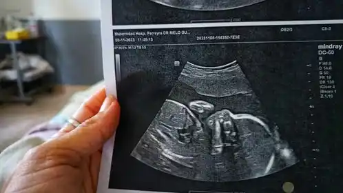Una futura mamá quiere agradecer a Policías y personal de Defensa Civil que la ayudó en la calle