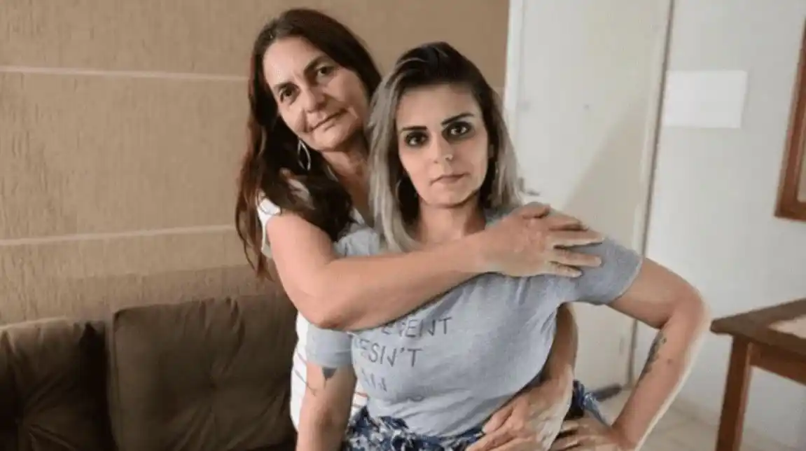 Tiene 31 años y por una enfermedad genética le sacaron un tumor de 30 kilos