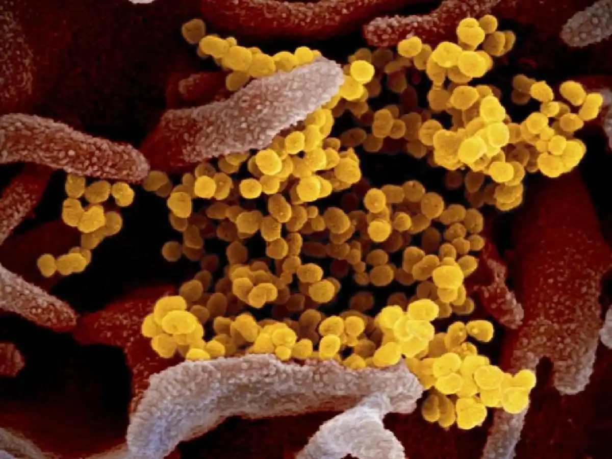 Desarrollan en el país un test que detecta anticuerpos contra el Covid-19