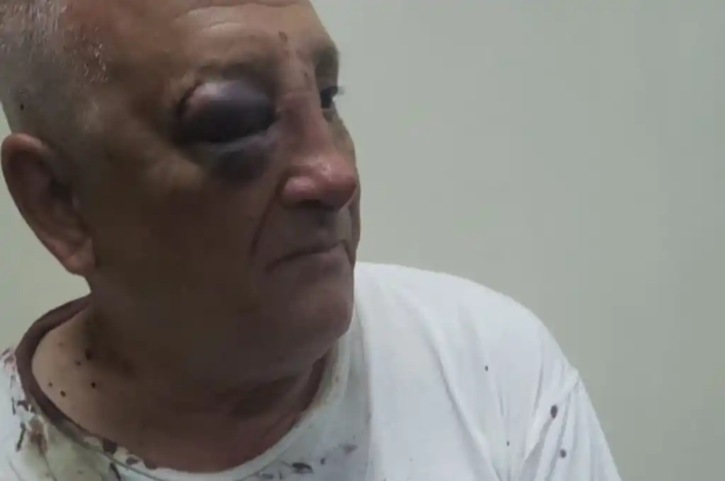 Inseguridad y violencia en Arroyo Leyes: los maniataron, golpearon y les llevaron todo