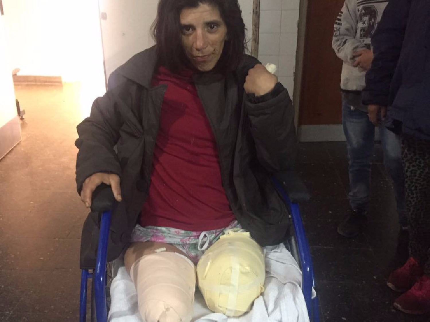 “No me mordieron, me comieron”: habló Viviana, la joven atacada por los perros