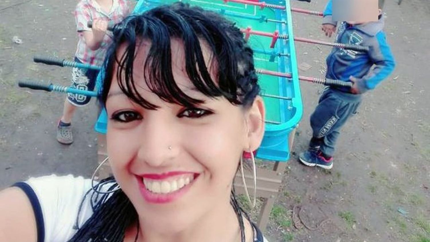 Mujer pelea por su vida con el 85% del cuerpo quemado tras ser atacada por su pareja