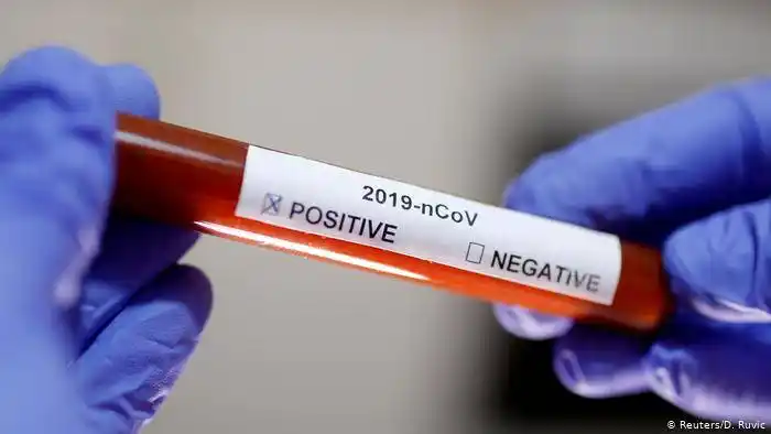 El Departamento Concordia registró 70 nuevos casos de coronavirus