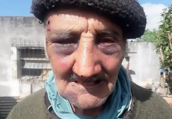 Para robarle, golpearon brutalmente a un anciano en Urdinarrain