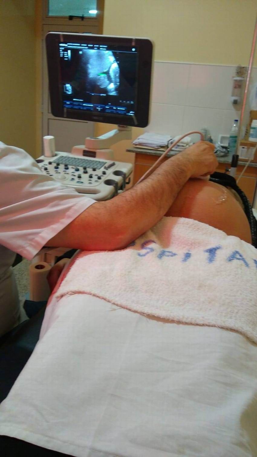 Operativo de la red de ecografías
en el hospital de San Martín Dos