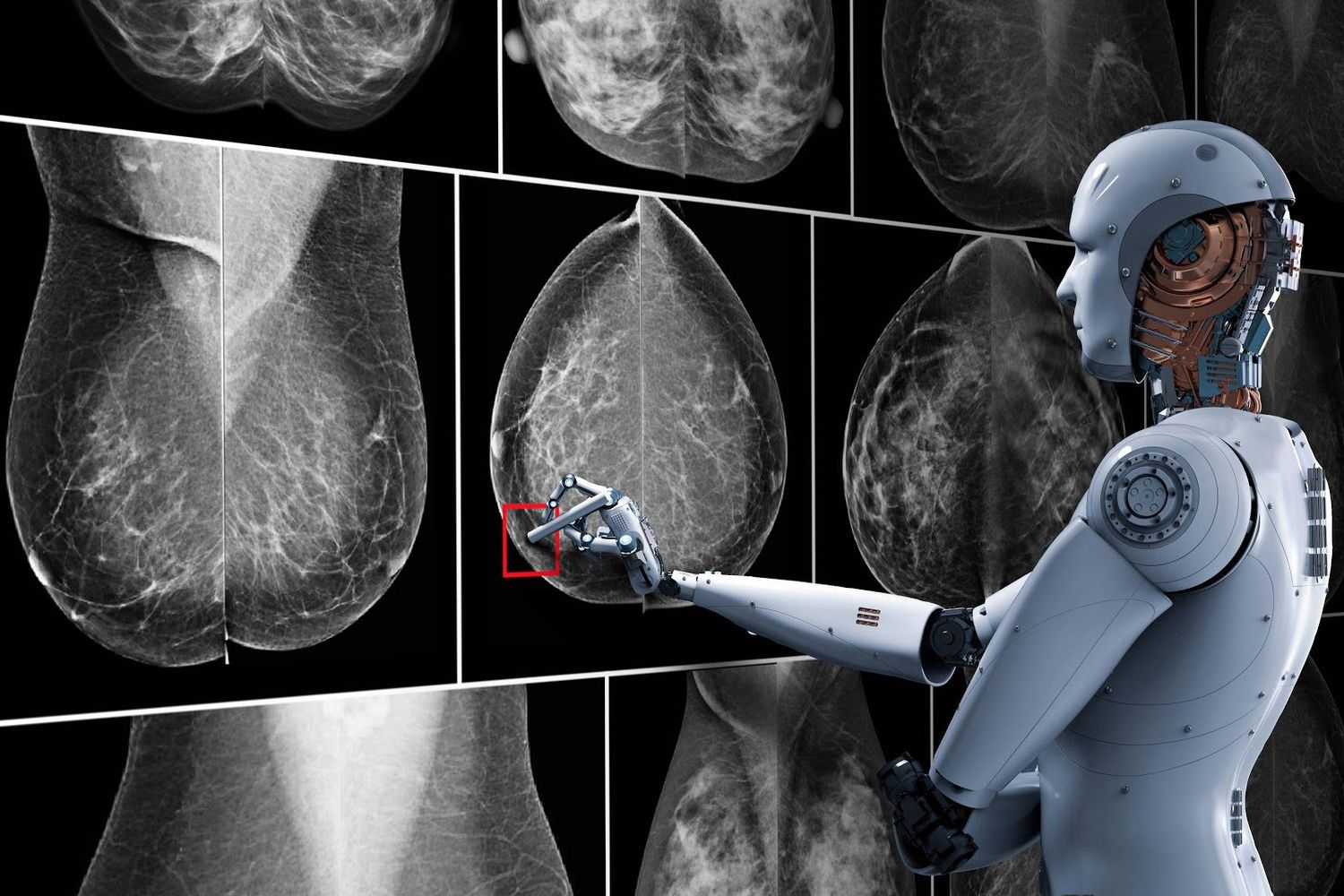 Cáncer de mamas puede ser detectado gracias a la Inteligencia Artificial