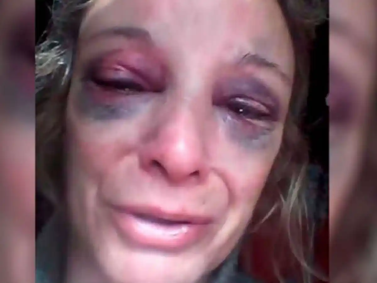 Su pareja le dio un ladrillazo en la cara porque se negó a tener sexo