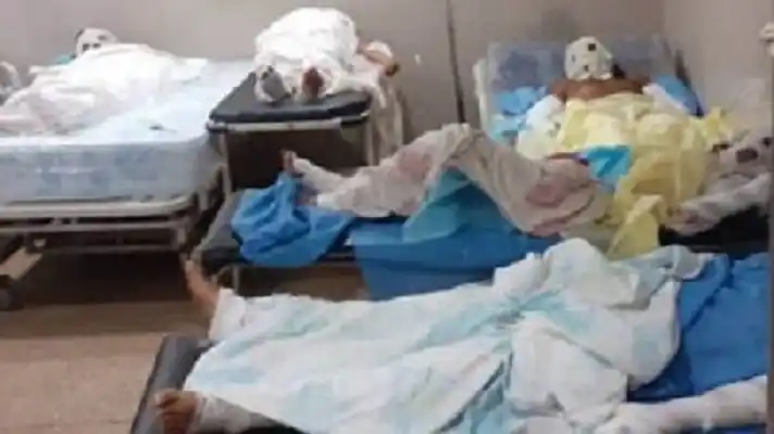 DEJARON DE FUNCIONAR los aires acondicionados donde se encuentran quemados de la explosión  en Monagas