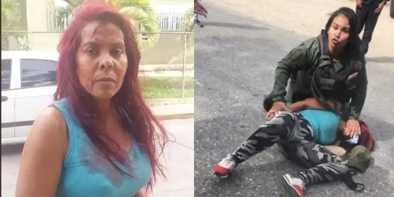 GNB que le partió la cabeza a una abogada en Lara habría sido detenida