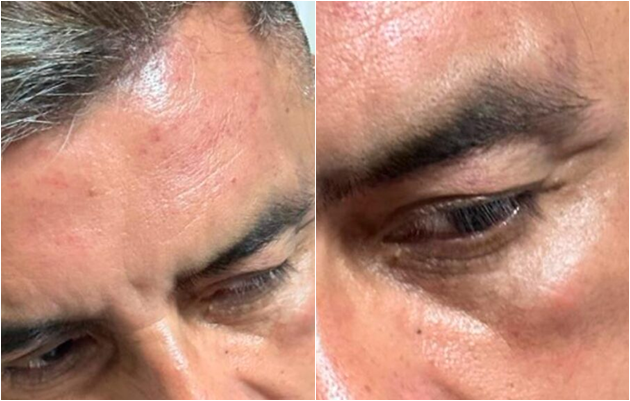 Lomas de Zamora: Repudian ataque a concejal del Frente de Todos
