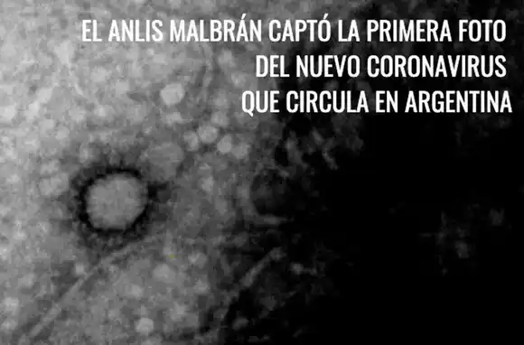 Se conoció la primera foto del Coronavirus que circula en el país