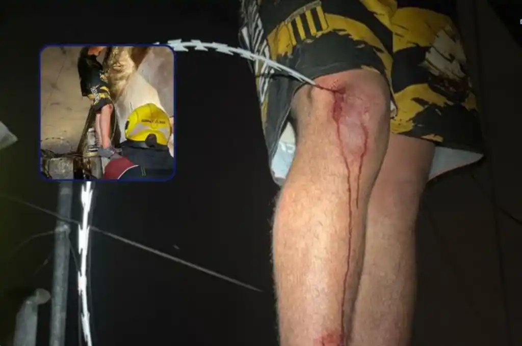El sujeto, se encontraba sobre una reja en una vivienda con el alambre clavado en su pierna derecha.