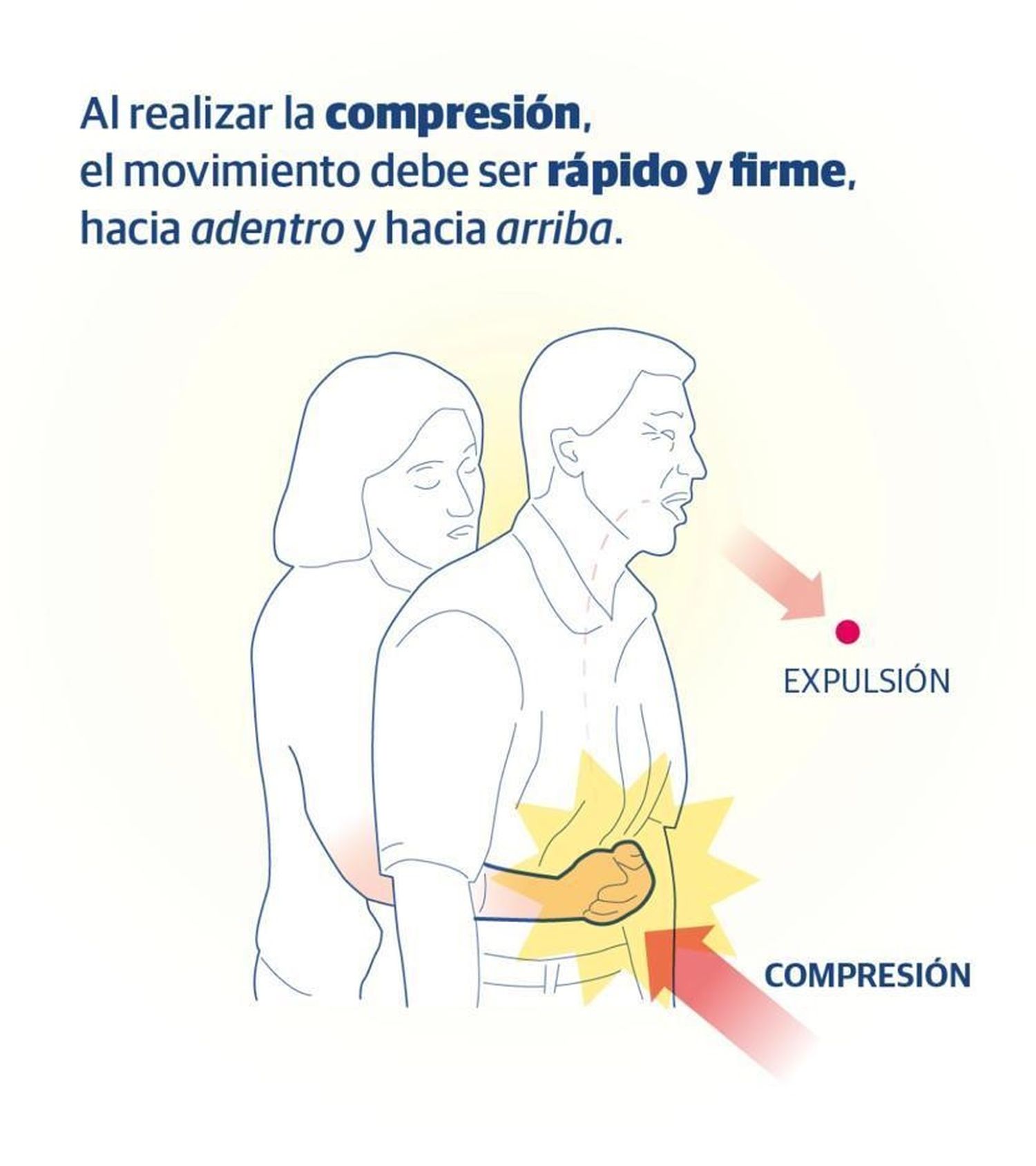 maniobra de Heimlich