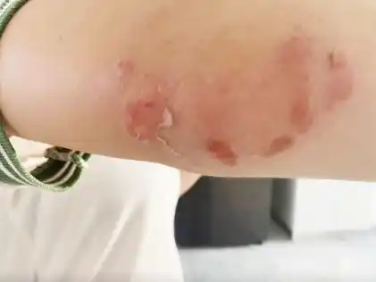 Violencia en la Escuela de Comercio 1: una alumna resultó con costilla fisurada