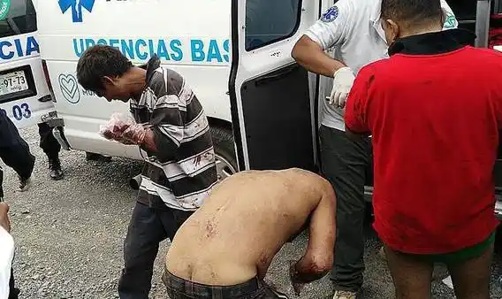 Horror en México: amputaron las manos de siete ladrones
