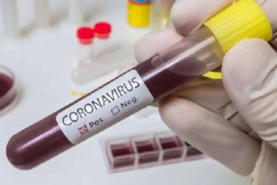 Concordia registró 96 nuevos casos de coronavirus