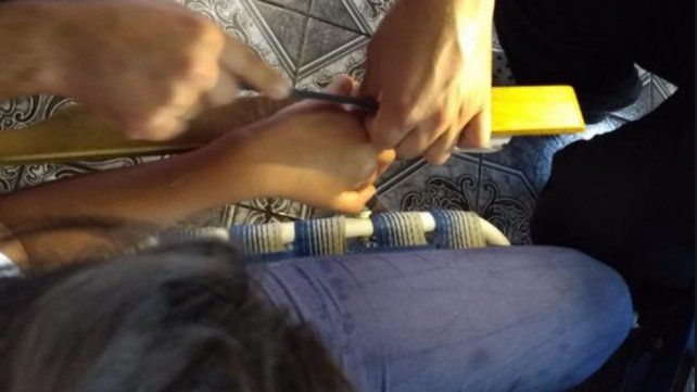 San Lorenzo: se le trabó el anillo en el dedo y debió recurrir a los bomberos
