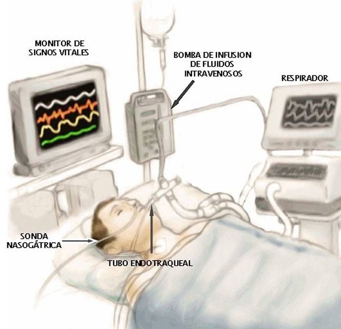 El virus corre mucho más rápido que cualquier posibilidad de respuesta
