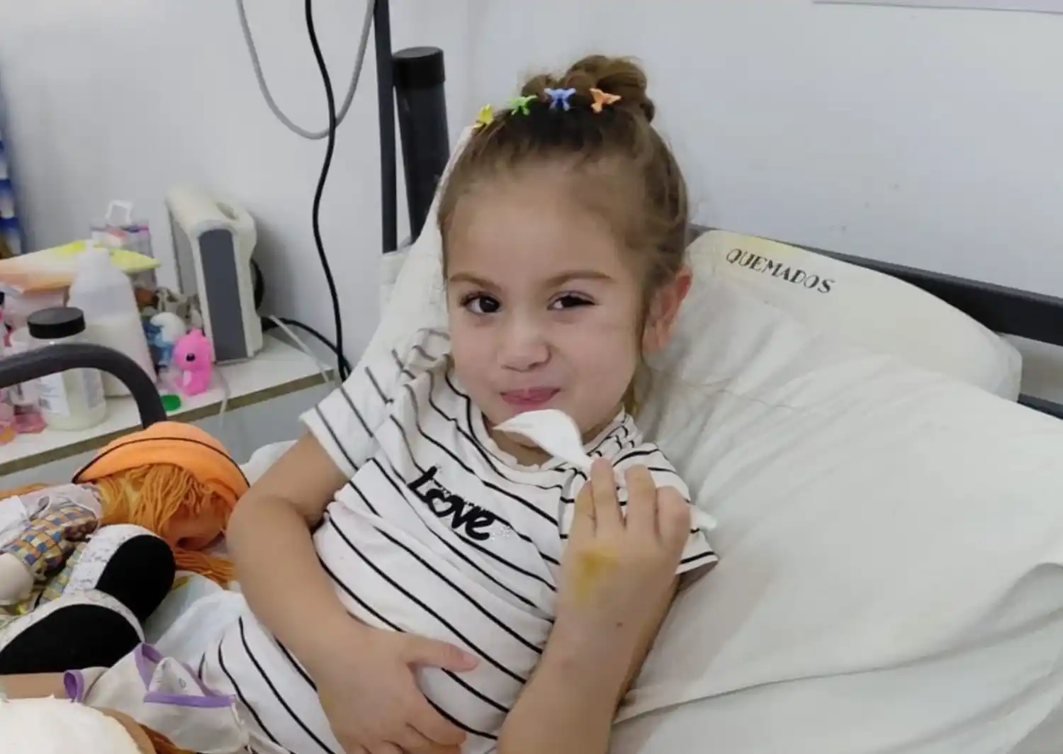 La pequeña sufrió quemaduras de aceite en la zona de sus piernas.