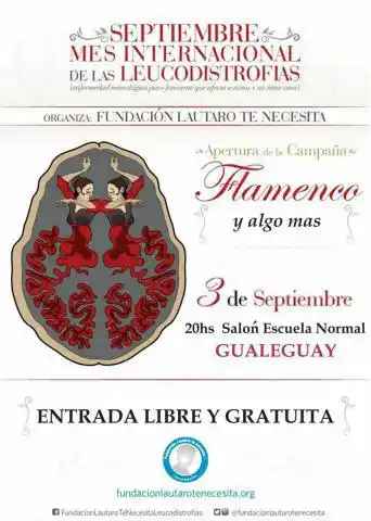 Evento solidario por el Mes Internacional por las Leucodistrofias