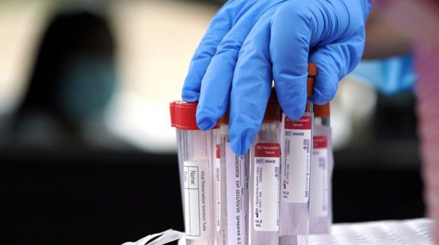 Hay más de 10 millones de contagios de Covid-19 en el mundo