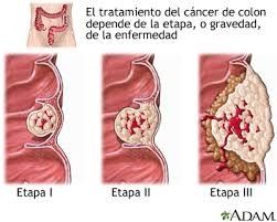 cancer