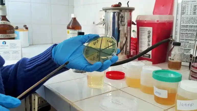 Se reportaron 117 nuevos fallecimientos y hubo otros 5.344 contagiados