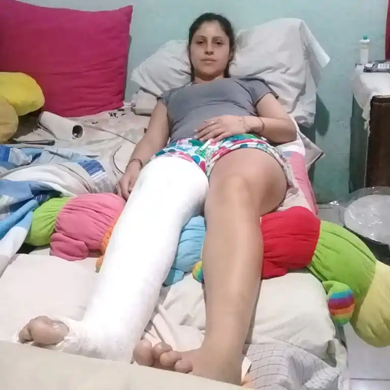 La tiraron al piso para robarle el celuar y le quebraron la pierna: "Gracias a que tenía la mochila puesta me salvé la espalda"