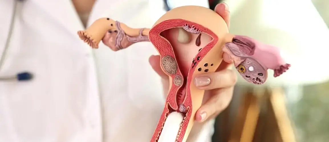 Cáncer de cuello
