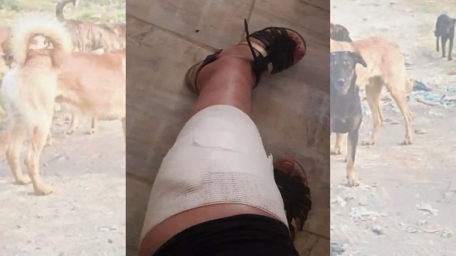 Una mujer debió ser atendida con urgencia tras ser mordida por un perro en una pierna donde había sufrido una trombosis.