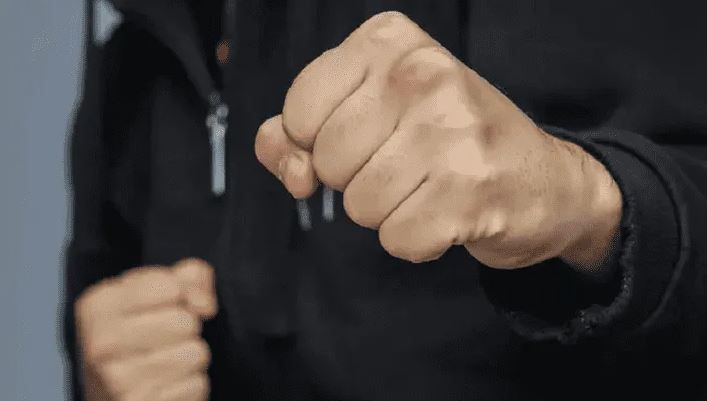 Le propuso un trío sexual a un compañero de trabajo: terminó con 4 dientes menos por la brutal trompada que le dieron